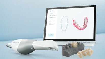 Extension of Ceramill CAD/CAM workflow—digital solutions lead the way into the dental practice