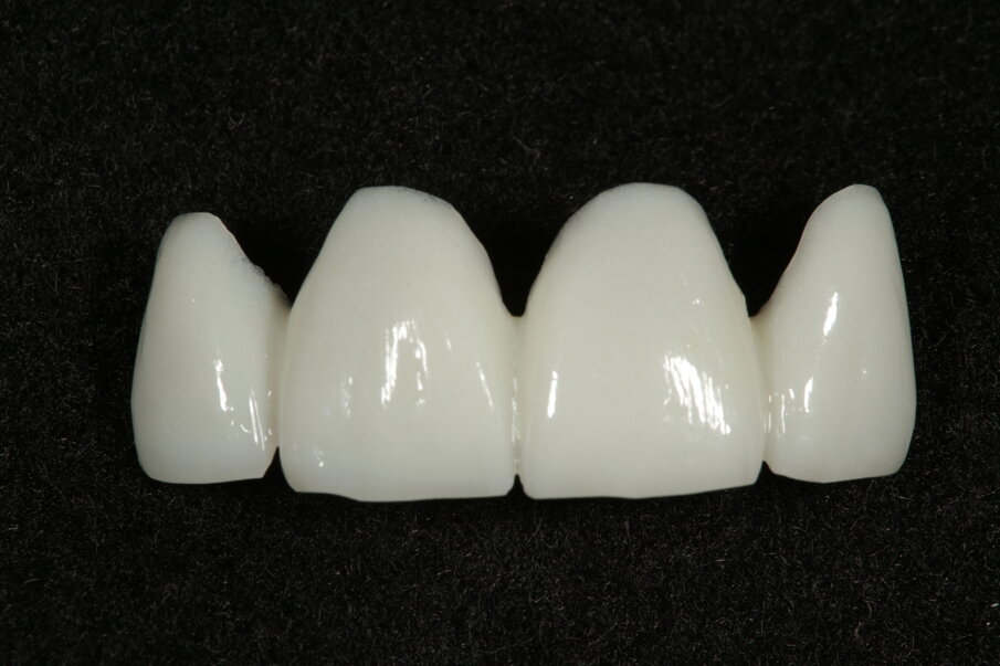 Fig.12