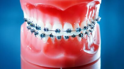 Strengere eisen voor buitenlandse tandarts-specialisten