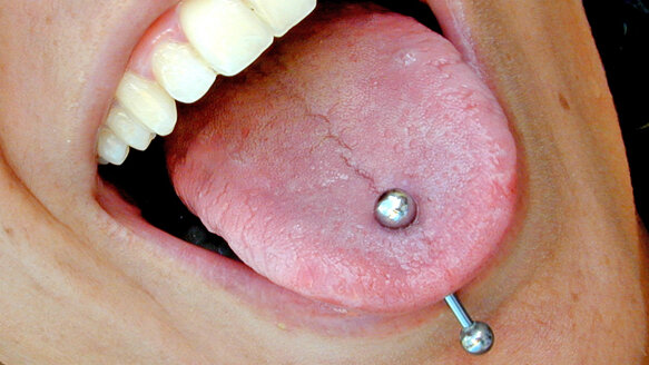 California Dental Association says oral piercings pose significant dangers to oral health