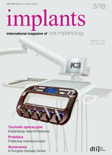 implants Poland No. 3, 2018