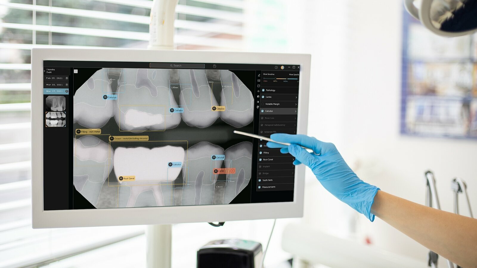El primer software de AI del mundo que interpreta radiografías dentales