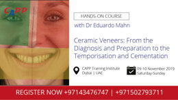Ceramic Veneers: From the Diagnosis and Preparation to the Temporisation and Cementation