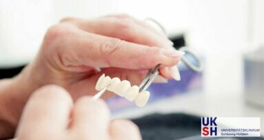Neue Studie zur Verankerung von Zahnprothesen