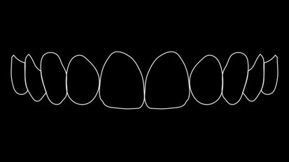 Figura 3. Simulación numérica de la sonrisa ideal.