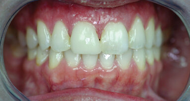 Systems, technology let practices deliver profitable, emergency cosmetic dentistry