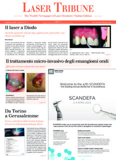 Laser Tribune Italy No. 1, 2014