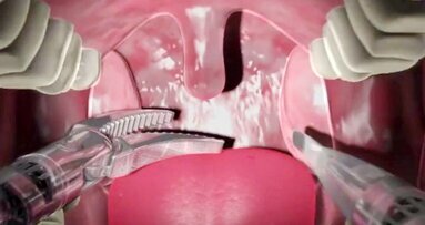 Усъвършенствани техники за роботизирана хирургия позволяват лечение на иноперабилни тумори в лицево-челюстната област