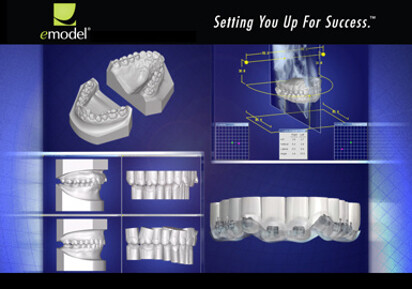 emodel: 3-D Digital Dental Models