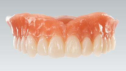 Ceramill FDS bietet nun auch Möglichkeit Zahnkränze und Zahnsegmente zu fräsen