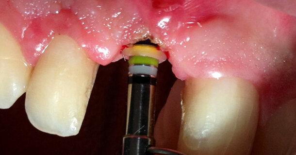 Altri Strumenti Di Misura Vari - Foto 6