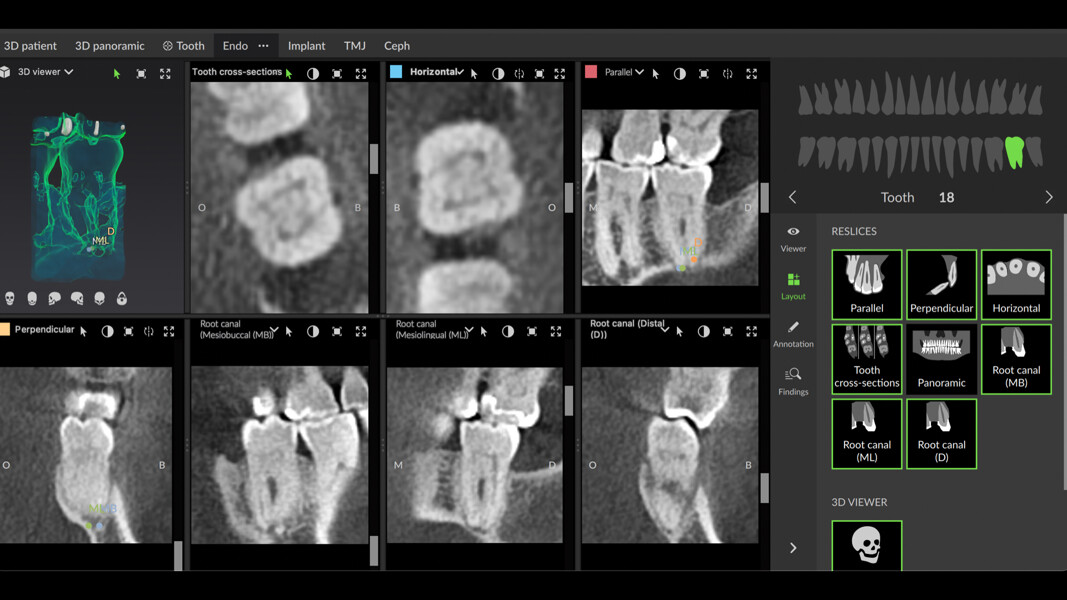 Fig. 9: Endodontic mode in DTX Studio Clinic in different sections for analysis of the case.