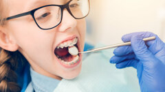 Studienergebnisse zu Zahnfehlstellungen bei Kindern