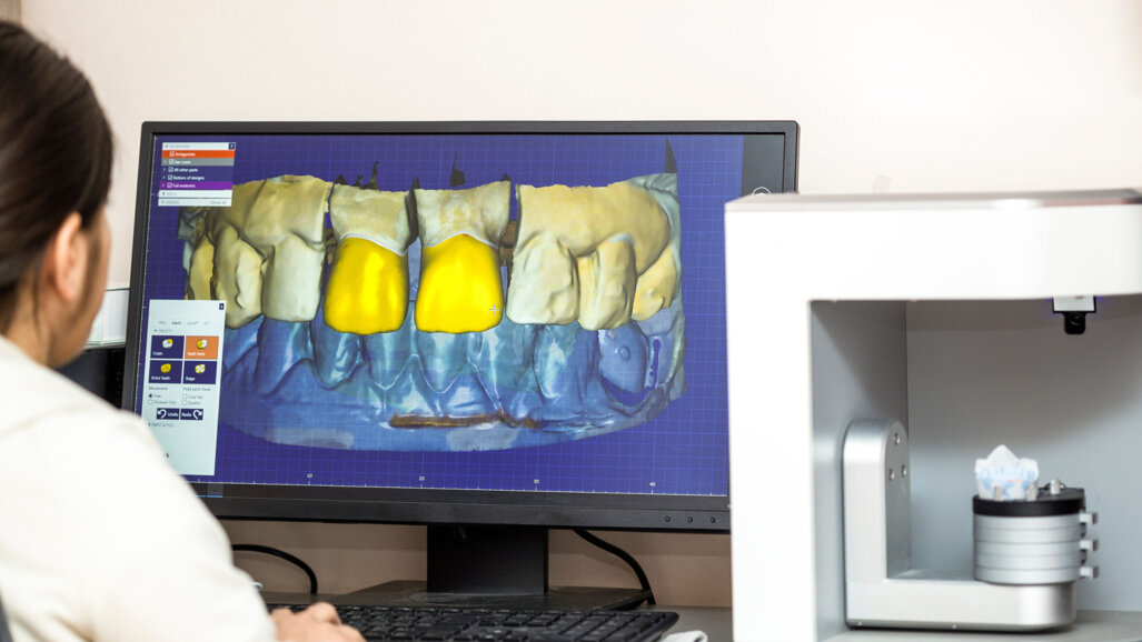 Interview on evaluating the costs of adding 3D printing to the dental practice