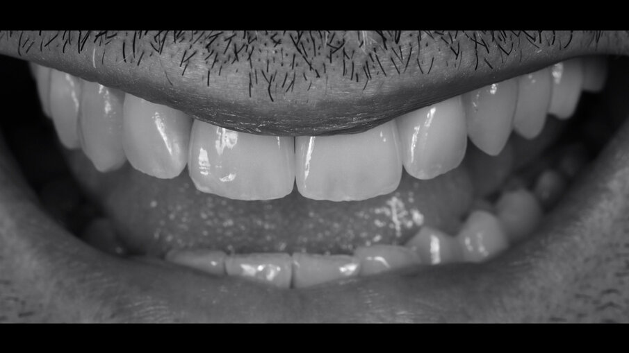 Figg. 17, 18_Armonia delle nuove forme e il rapporto dei denti con le labbra del paziente.