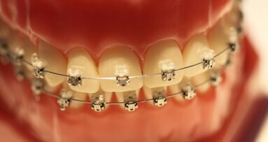Fałszywe aparaty ortodontyczne szkodzą zdrowiu