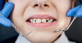 Dental News - Interview: Oral health and intellectual disability