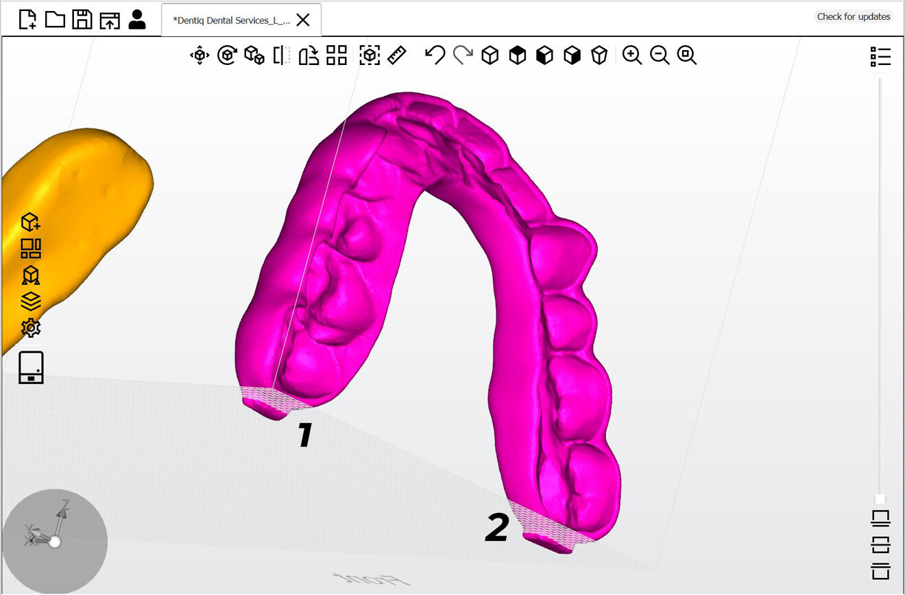 Fig. 7: Close-up view and position of the splint to be printed (Asiga Composer). 