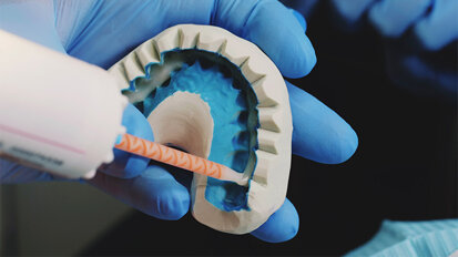 Une nouvelle colle pourrait changer le monde de la dentisterie