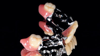 Cherry on top in complete denture prosthetics: individuality and naturalness