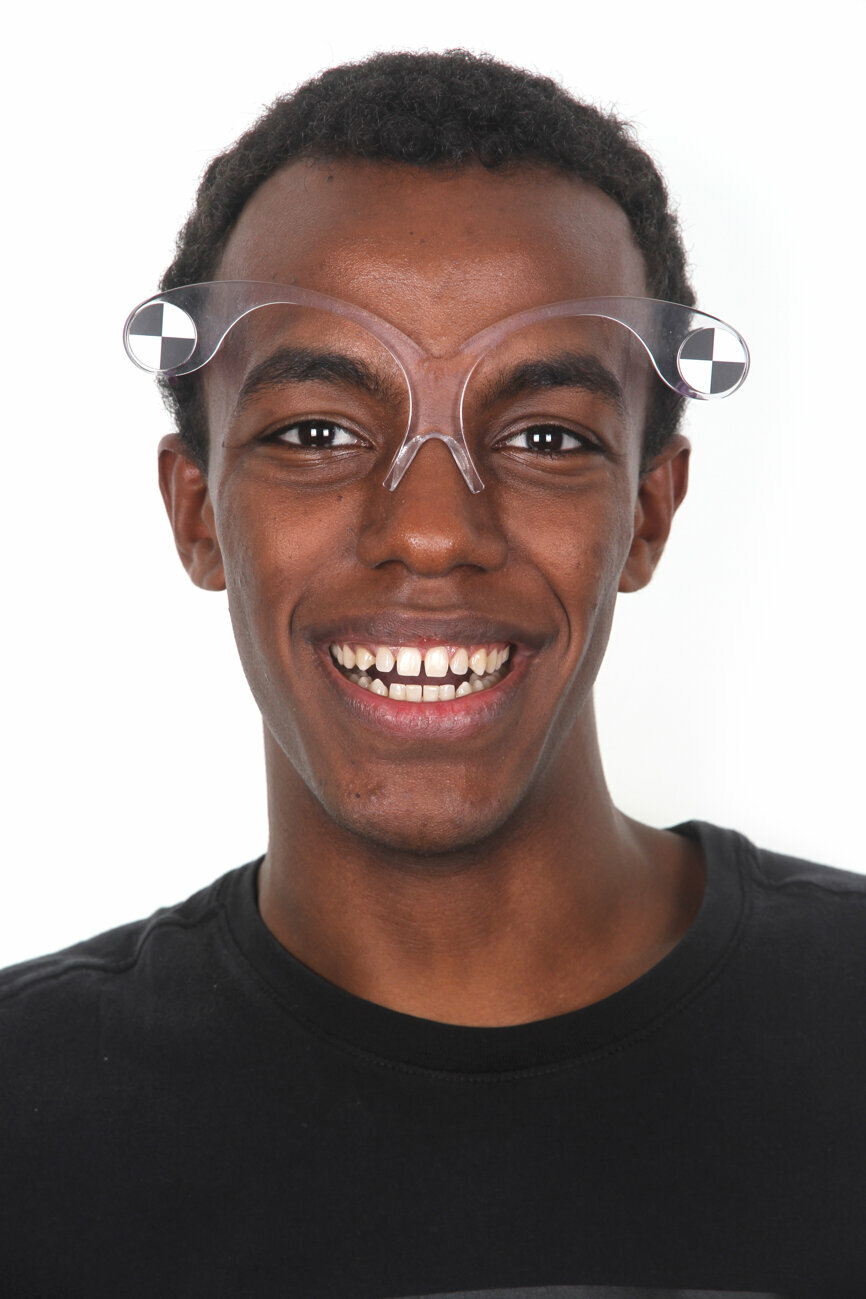 Fig. 10: Digital smile system glasses and digital dental library selected by the software for the smile planning.
