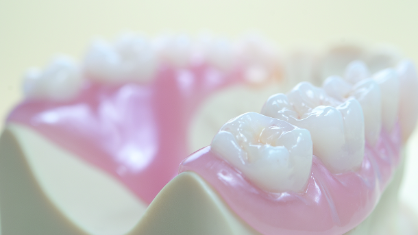 Thermoplastic materials in dental technology