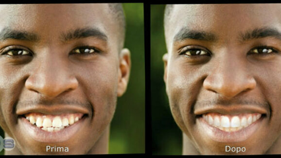 Projetar um novo sorriso a partir de uma foto facial