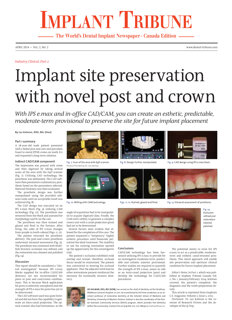 Implant Tribune Canada No. 2, 2014