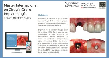Primer Máster Internacional ONLINE en Cirugía Oral e lmplantología