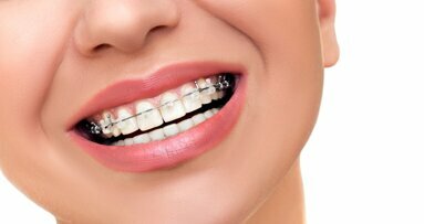 Orthodontics: Short-term gains … long-term problems?