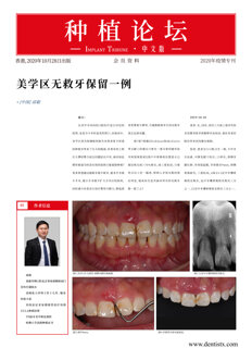 Implant Tribune China No. 1, 2020