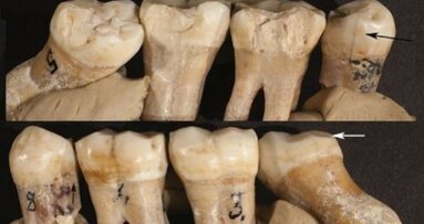 Evidence of prehistoric dentistry found in Neanderthal teeth