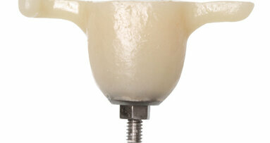 GCL Systems and Benco Dental partner to deliver dental implant soft tissue solutions