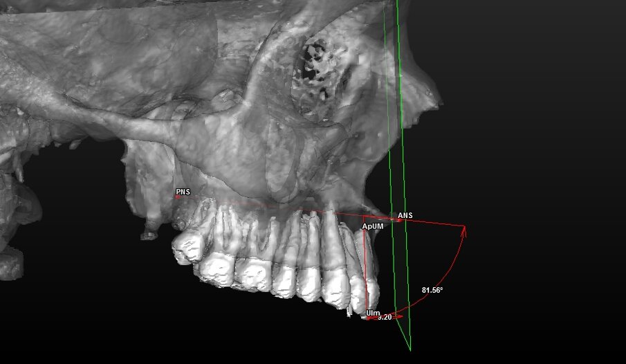 Fig. 9_Valutazione della componente dentale in visione di profilo.