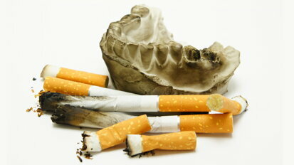 Redukcja szkód związanych z tytoniem, kluczowy element terapii periodontologicznej