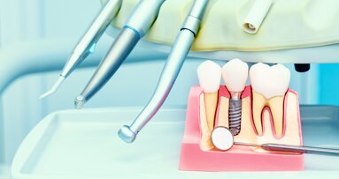 Taking stock and looking ahead—the current and future dental implant landscape