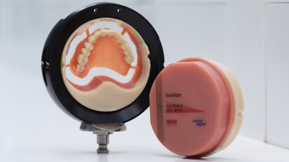 Ivoclar y exocad amplían las opciones de las prótesis digitales con la integración en DentalCAD