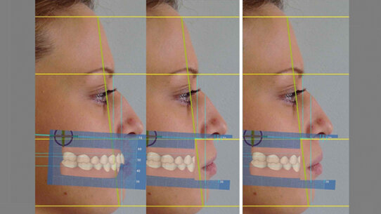 Analisi estetica dento-facciale con l’uso di software 3D: sinergia tra Medicina e Odontoiatria estetica