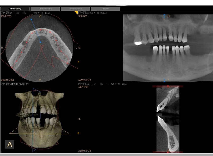 Fig. 3: CBCT scan obtained using the CS 8100 3D.