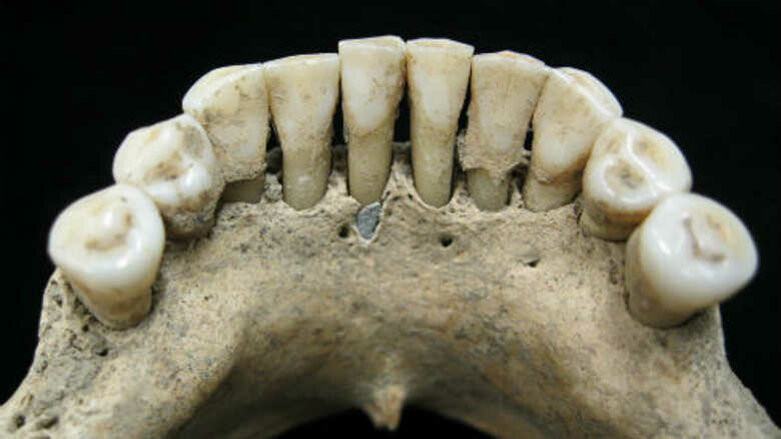 Pesquisadores descobrem pigmentos de lápis-lazúli na mandíbula da mulher medieval