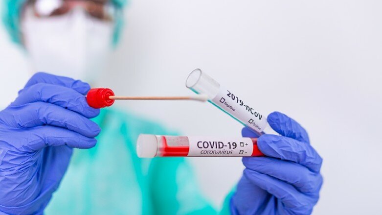 COVID-19: indagini e test epidemiologici. Proposta AIO al Ministro della Salute Roberto Speranza