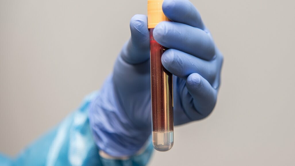 Po raz pierwszy podano ludziom krew wytworzoną w laboratorium