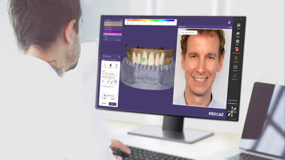 Exocad introduce il software DentalCAD 3.1 Rijeka
