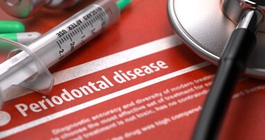 Knowledge about risk factors associated with periodontal disease among patients referred to a specialist periodontal clinic