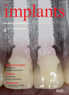 implants Poland No. 4, 2015