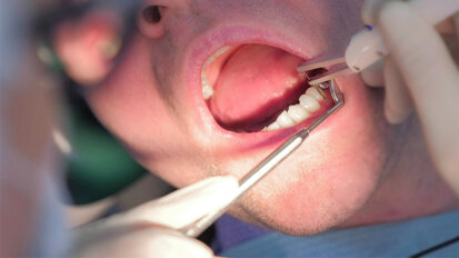 One step closer to fighting periodontitis: New dental gel reduces periodontal symptoms