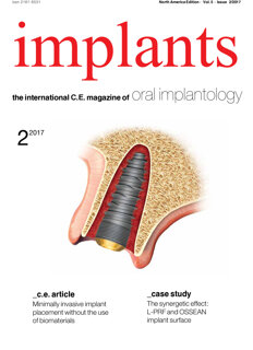 implants C.E. No. 2, 2017