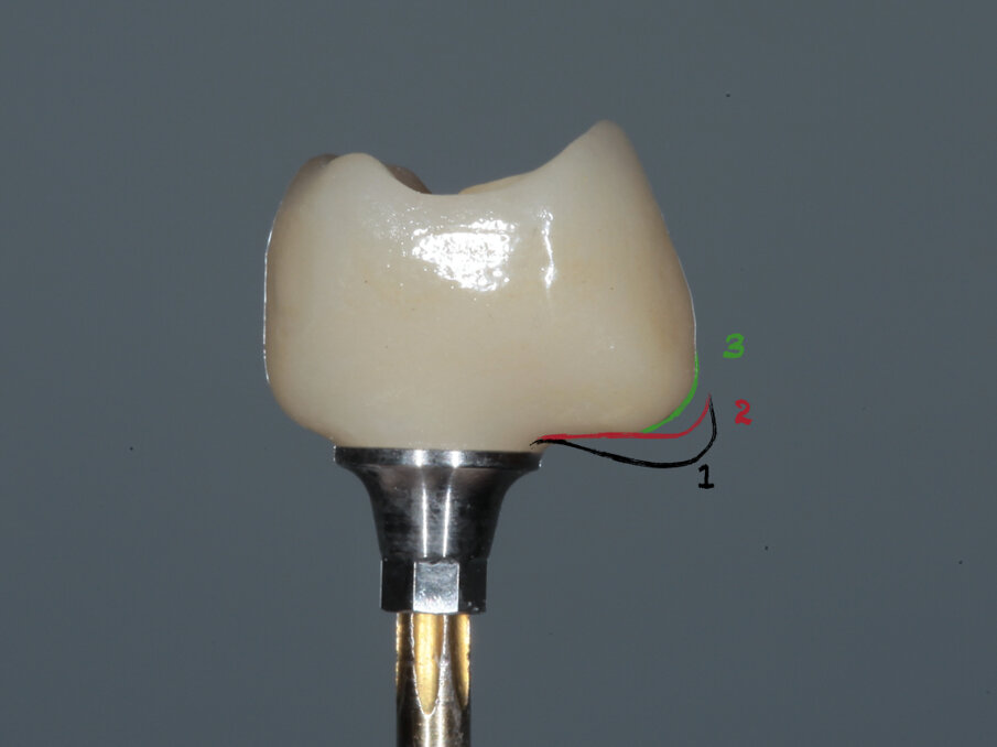 Fig. 26