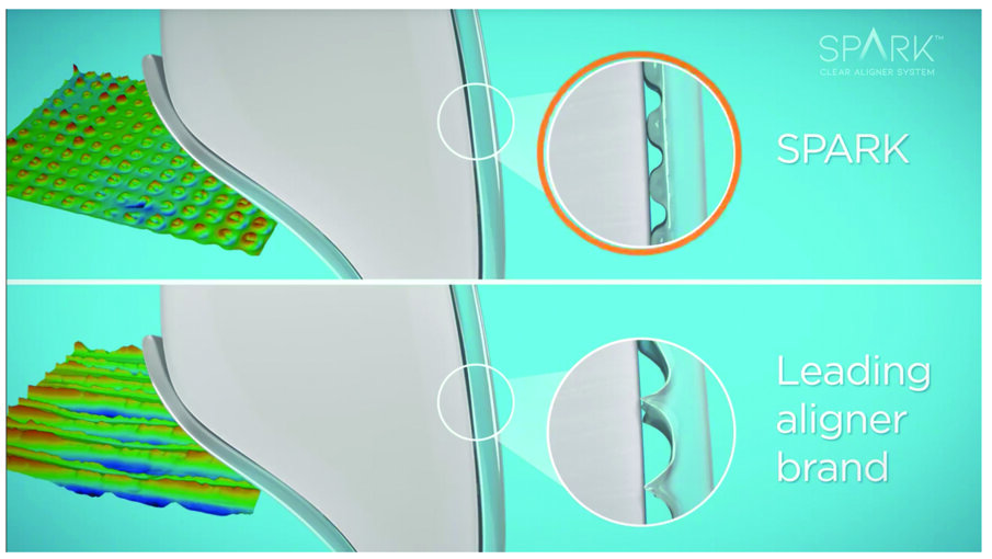 Fig. 9. At top, the high-resolution printed Spark aligner material provides more surface area in contact with the tooth compared to the leading clear aligner brand on the bottom.