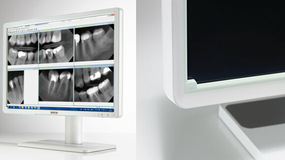 Écrans d'imagerie dentaire Eonis : la haute qualité des images pour l'interprétation et la revue des images dentaires